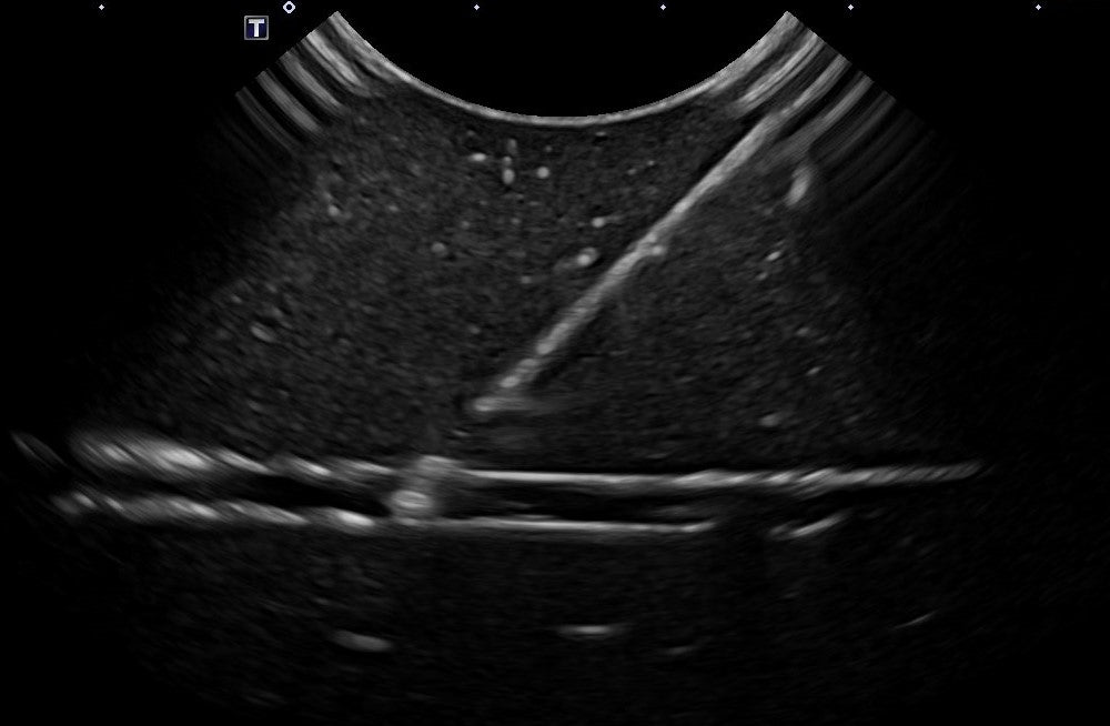 TUBES Ultrasound Training Model