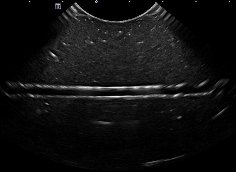 TUBES Ultrasound Training Model