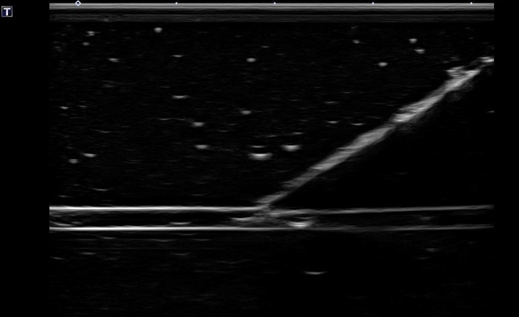 TUBES Ultrasound Training Model